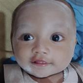 Sự G